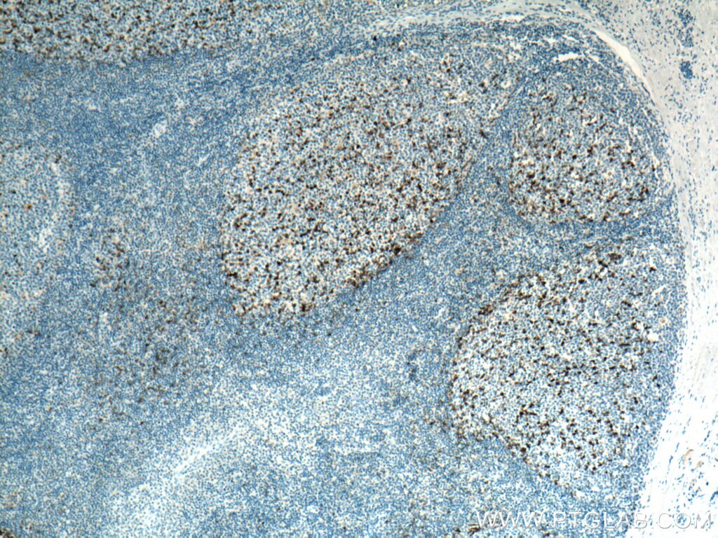 Immunohistochemistry (IHC) staining of human tonsillitis tissue using PD-1/CD279 Monoclonal antibody (66220-1-Ig)