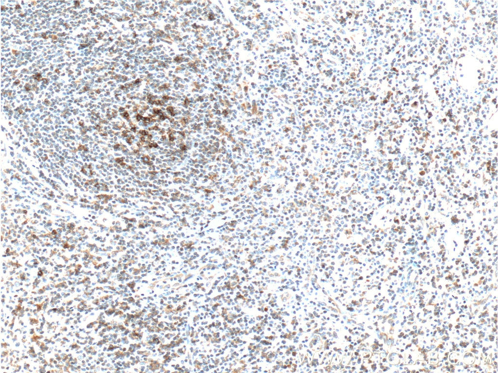 Immunohistochemistry (IHC) staining of human tonsillitis tissue using PD-1/CD279 Monoclonal antibody (66220-1-Ig)