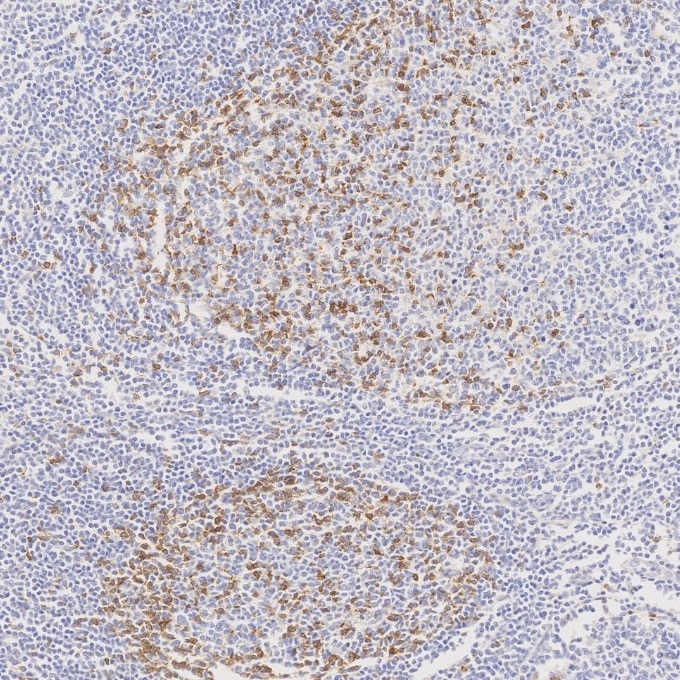 IHC staining of human tonsillitis using 66220-1-Ig Immunohistochemistry (IHC) staining of human tonsillitis tissue using PD-1/CD279 Monoclonal antibody (66220-1-Ig)