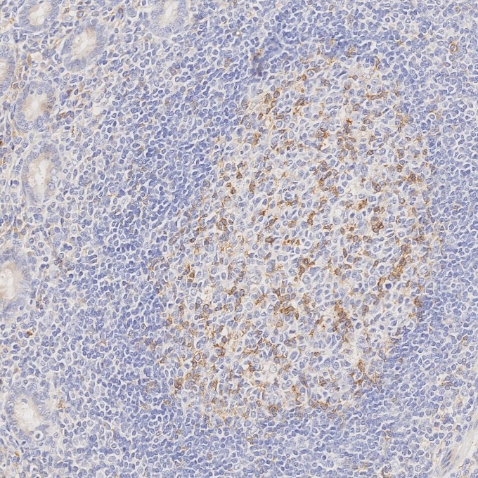 IHC staining of human appendicitis using 66220-1-Ig Immunohistochemistry (IHC) staining of human appendicitis tissue using PD-1/CD279 Monoclonal antibody (66220-1-Ig)