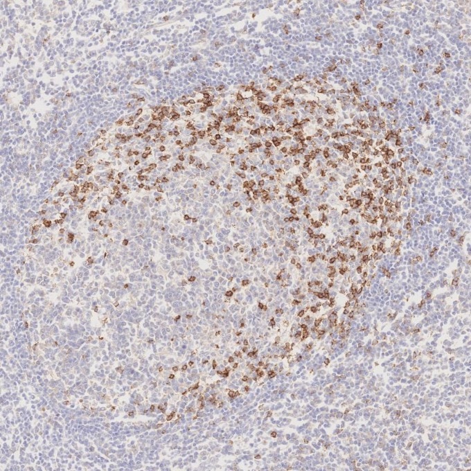 IHC staining of human tonsillitis using 66220-1-Ig Immunohistochemistry (IHC) staining of human tonsillitis tissue using PD-1/CD279 Monoclonal antibody (66220-1-Ig)