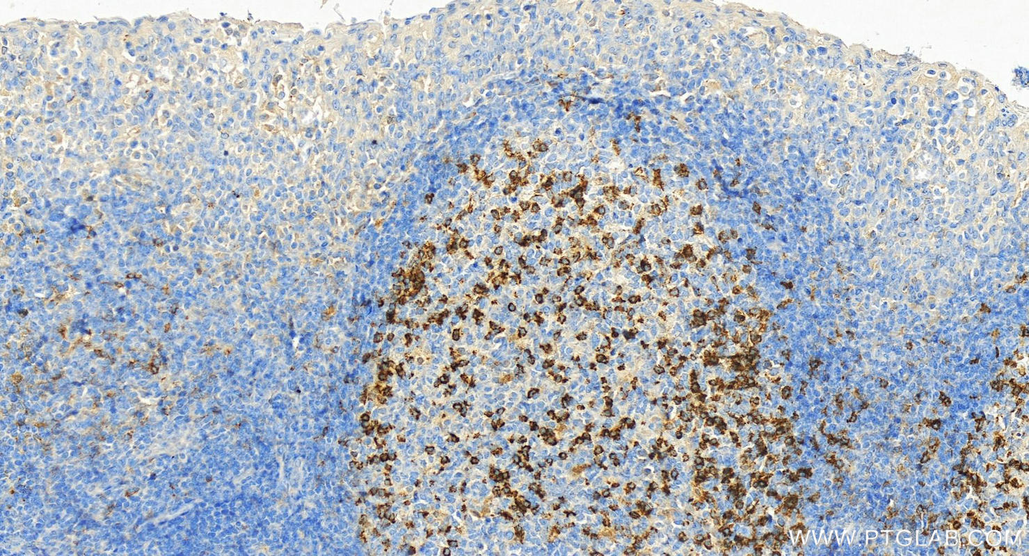 Immunohistochemistry (IHC) staining of human tonsillitis tissue using PD-1/CD279 Monoclonal antibody (66220-1-Ig)