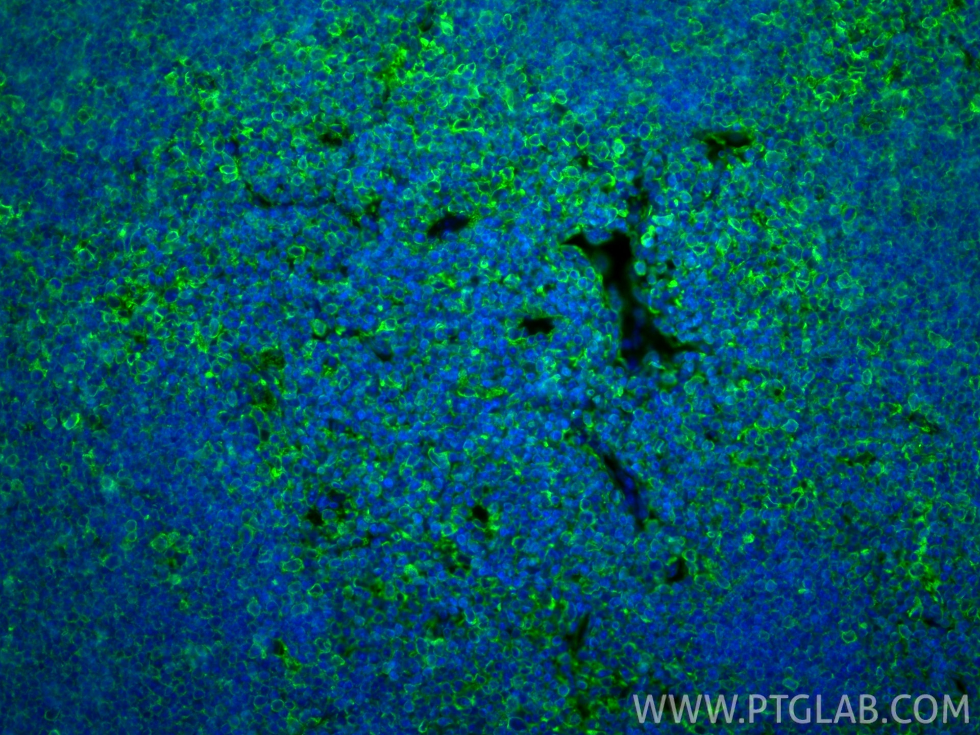 Immunofluorescence (IF) / fluorescent staining of mouse thymus tissue using PD-1/CD279 Recombinant monoclonal antibody (83516-6-RR)
