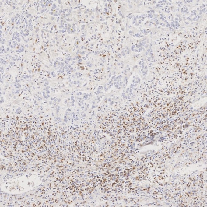 IHC staining of human liver using 98068-1-RR Immunohistochemistry (IHC) staining of human liver tissue using Anti-Human PD-1/CD279 Rabbit Recombinant Antibody (98068-1-RR)