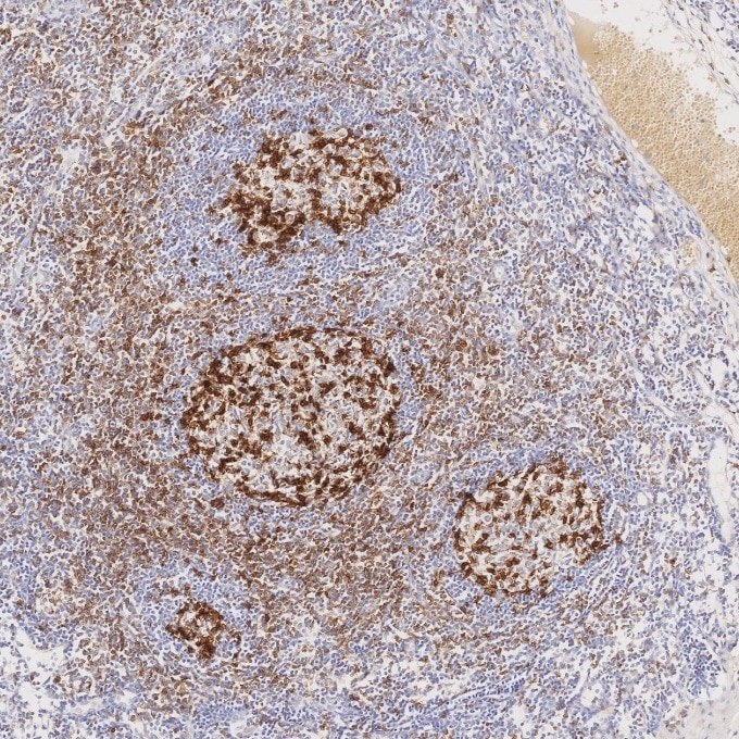 IHC staining of human tonsillitis using 98068-1-RR Immunohistochemistry (IHC) staining of human tonsillitis tissue using Anti-Human PD-1/CD279 Rabbit Recombinant Antibody (98068-1-RR)