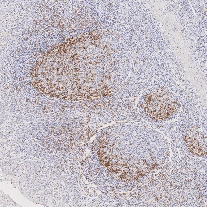 IHC staining of human tonsillitis using 98068-1-RR Immunohistochemistry (IHC) staining of human tonsillitis tissue using Anti-Human PD-1/CD279 Rabbit Recombinant Antibody (98068-1-RR)