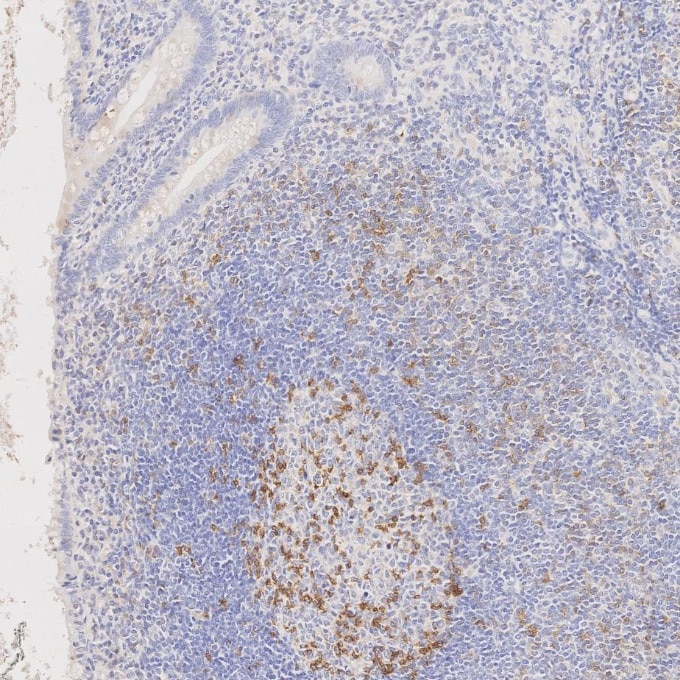 IHC staining of human appendicitis using 98068-1-RR Immunohistochemistry (IHC) staining of human appendicitis tissue using Anti-Human PD-1/CD279 Rabbit Recombinant Antibody (98068-1-RR)