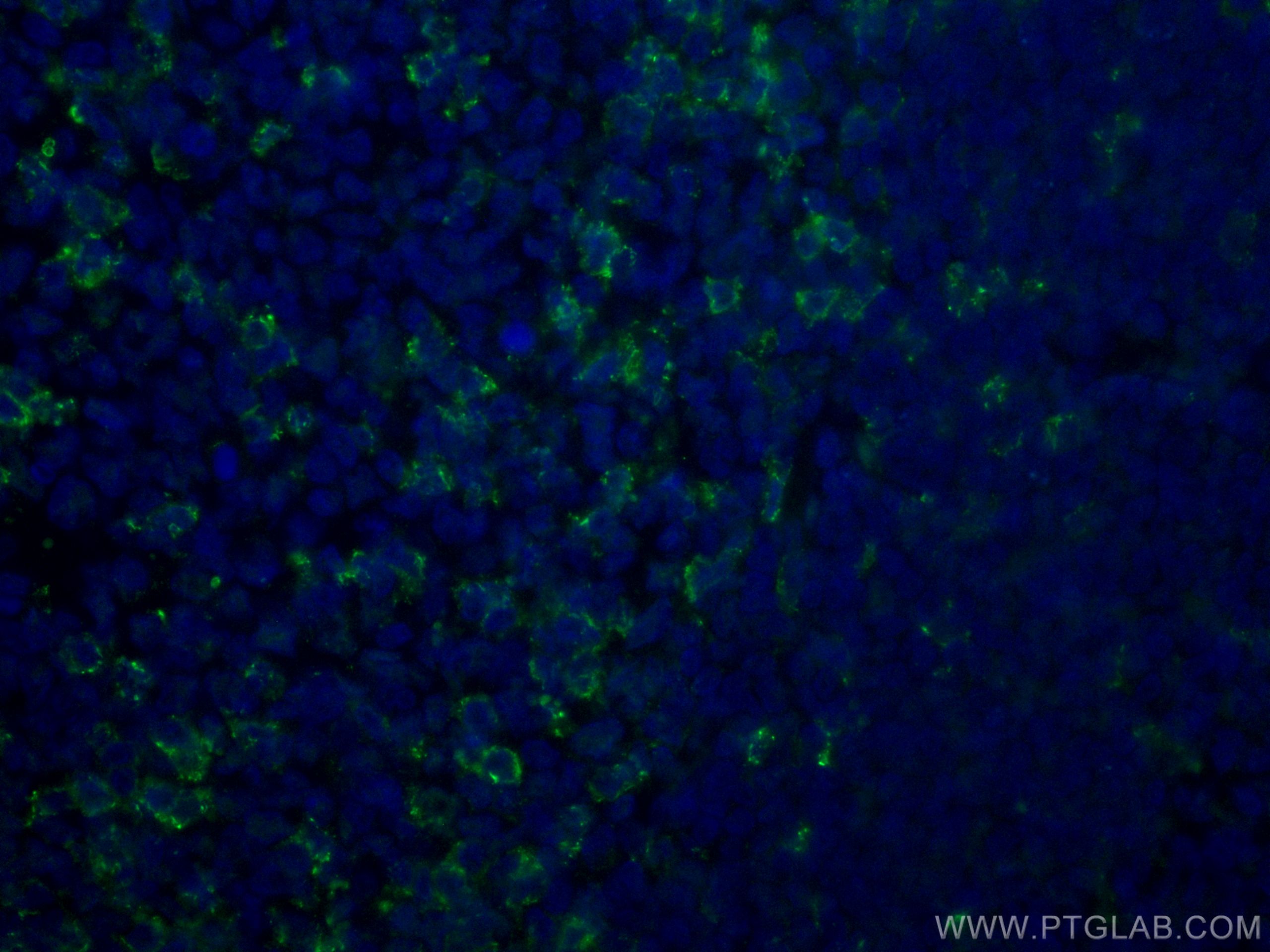 Immunofluorescence (IF) / fluorescent staining of human tonsillitis tissue using CoraLite® Plus 488-conjugated PD-1/CD279 Monoclona (CL488-66220)