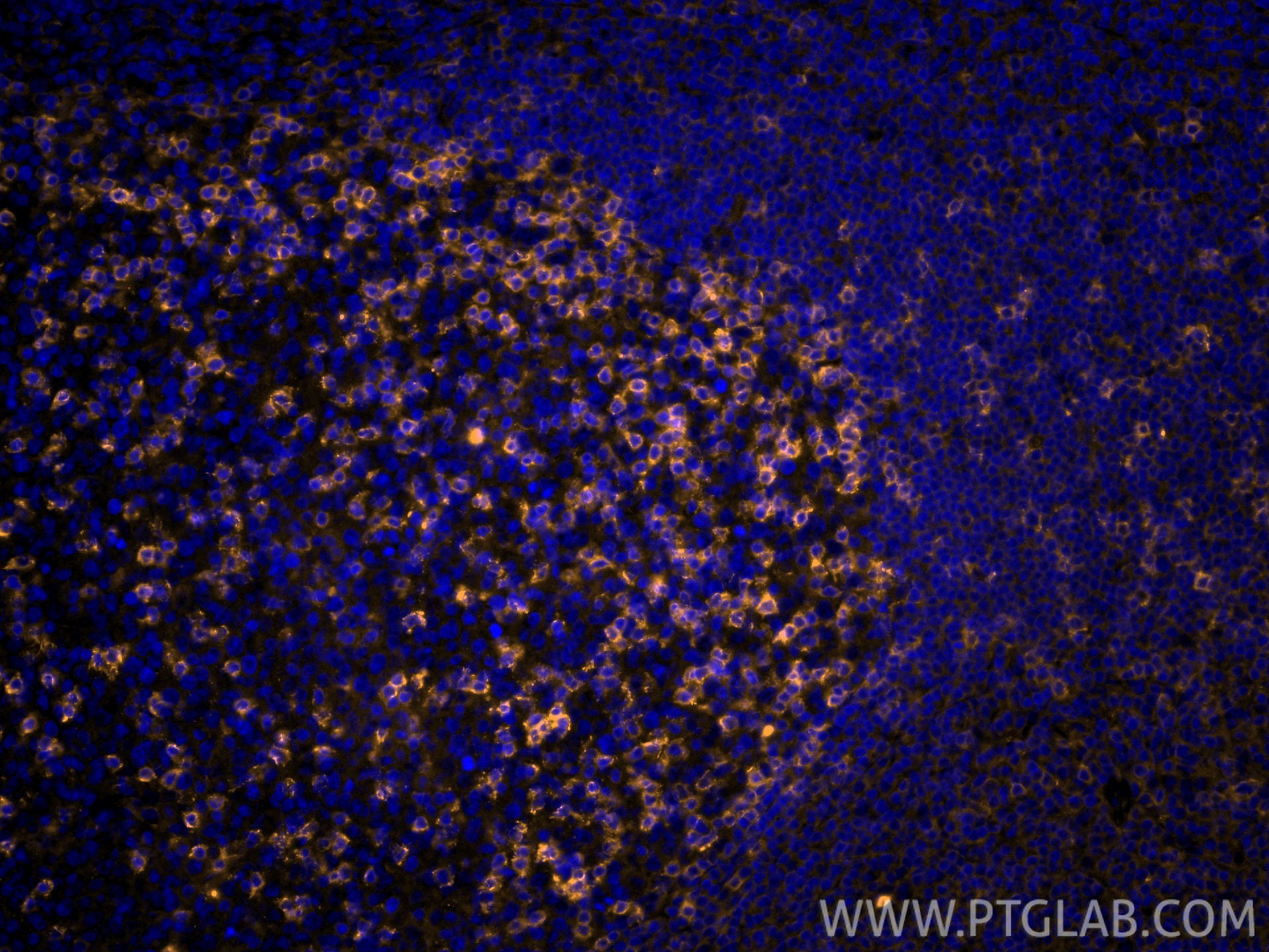 IF Staining of human tonsillitis using CL555-66220 Immunofluorescence (IF) / fluorescent staining of human tonsillitis tissue using CoraLite®555-conjugated PD-1/CD279 Monoclonal anti (CL555-66220)