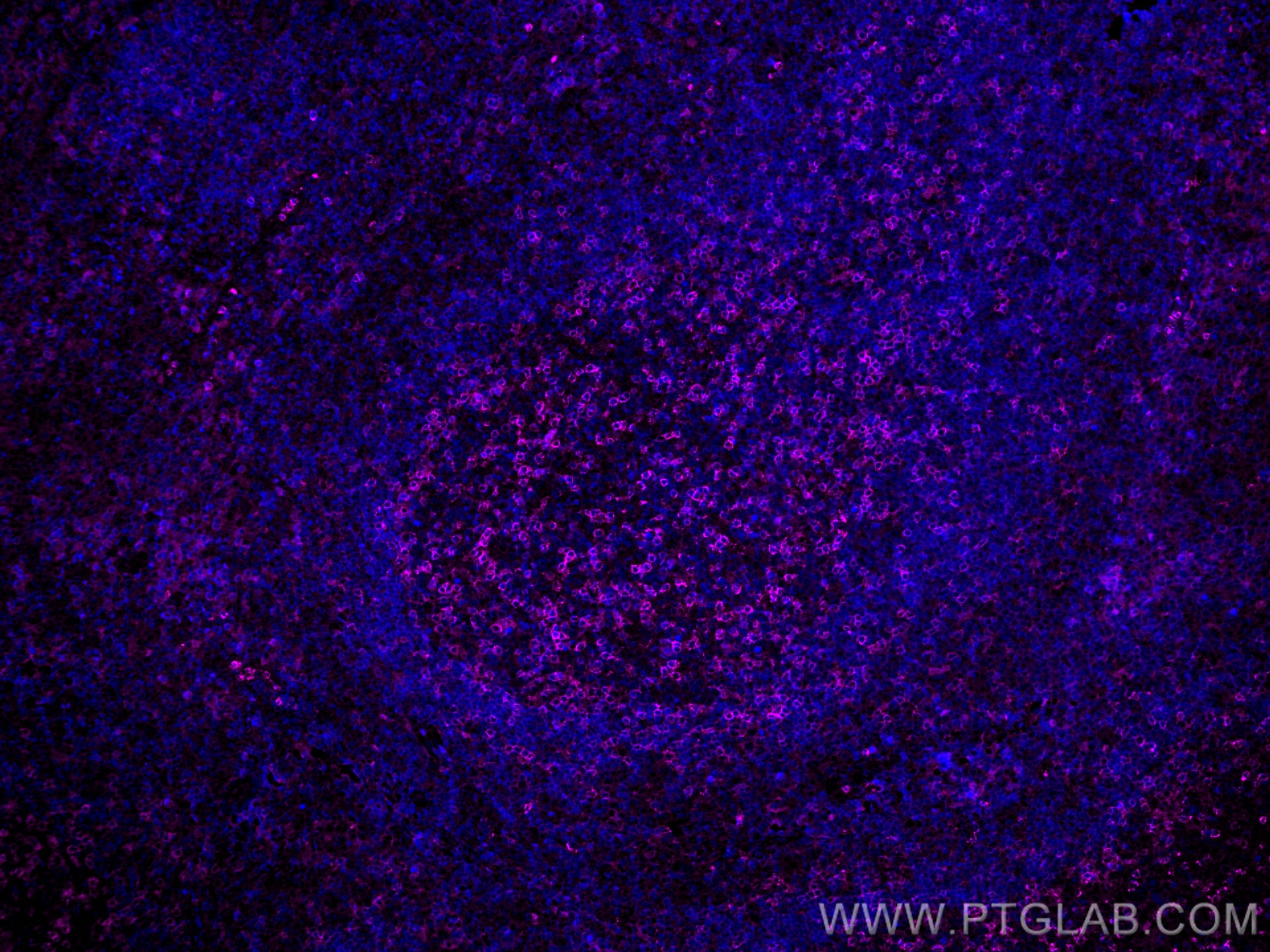 Immunofluorescence (IF) / fluorescent staining of human tonsillitis tissue using CoraLite® Plus 647-conjugated PD-1/CD279 Monoclona (CL647-66220)