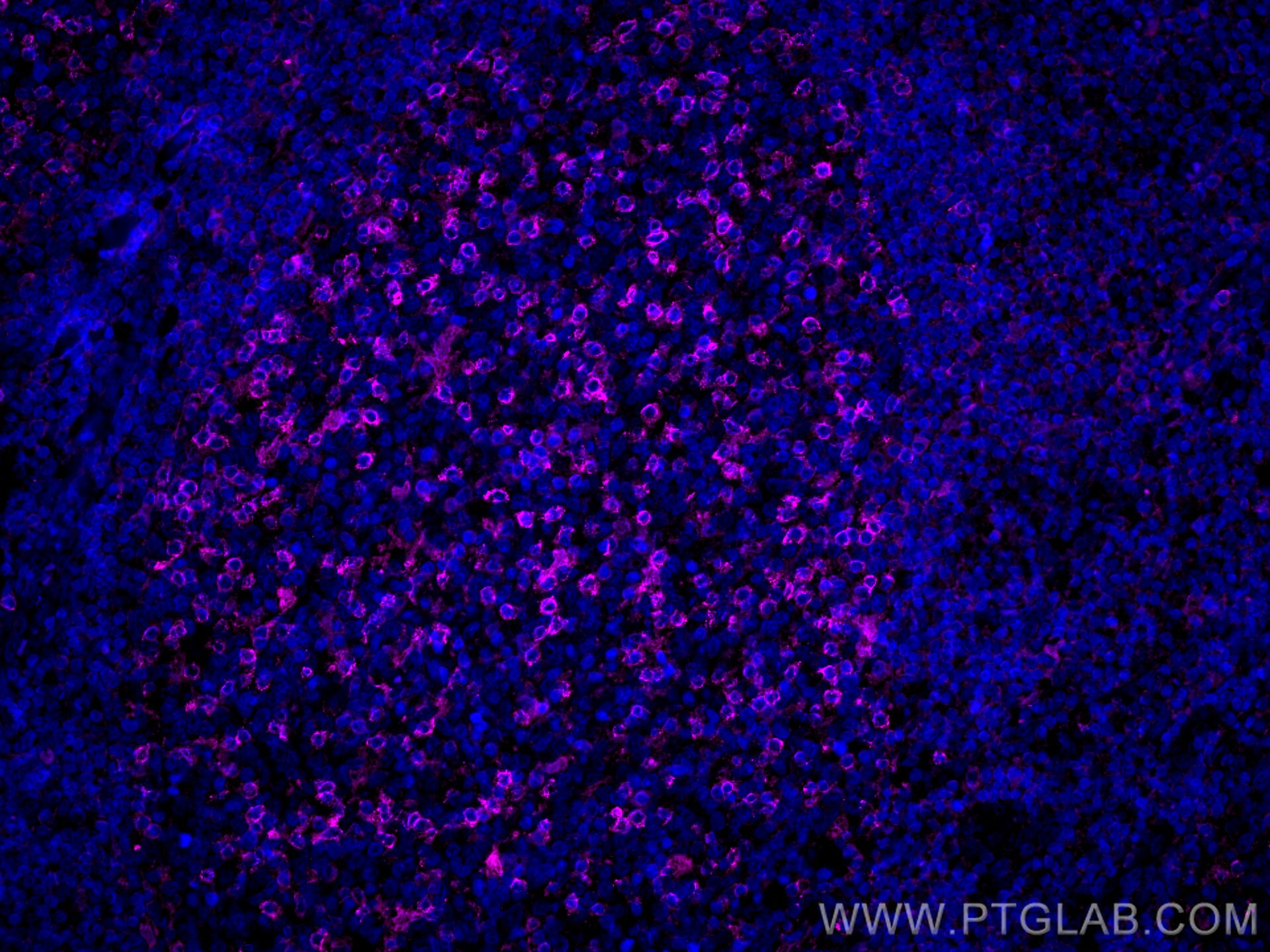 Immunofluorescence (IF) / fluorescent staining of human tonsillitis tissue using CoraLite® Plus 647-conjugated PD-1/CD279 Monoclona (CL647-66220)