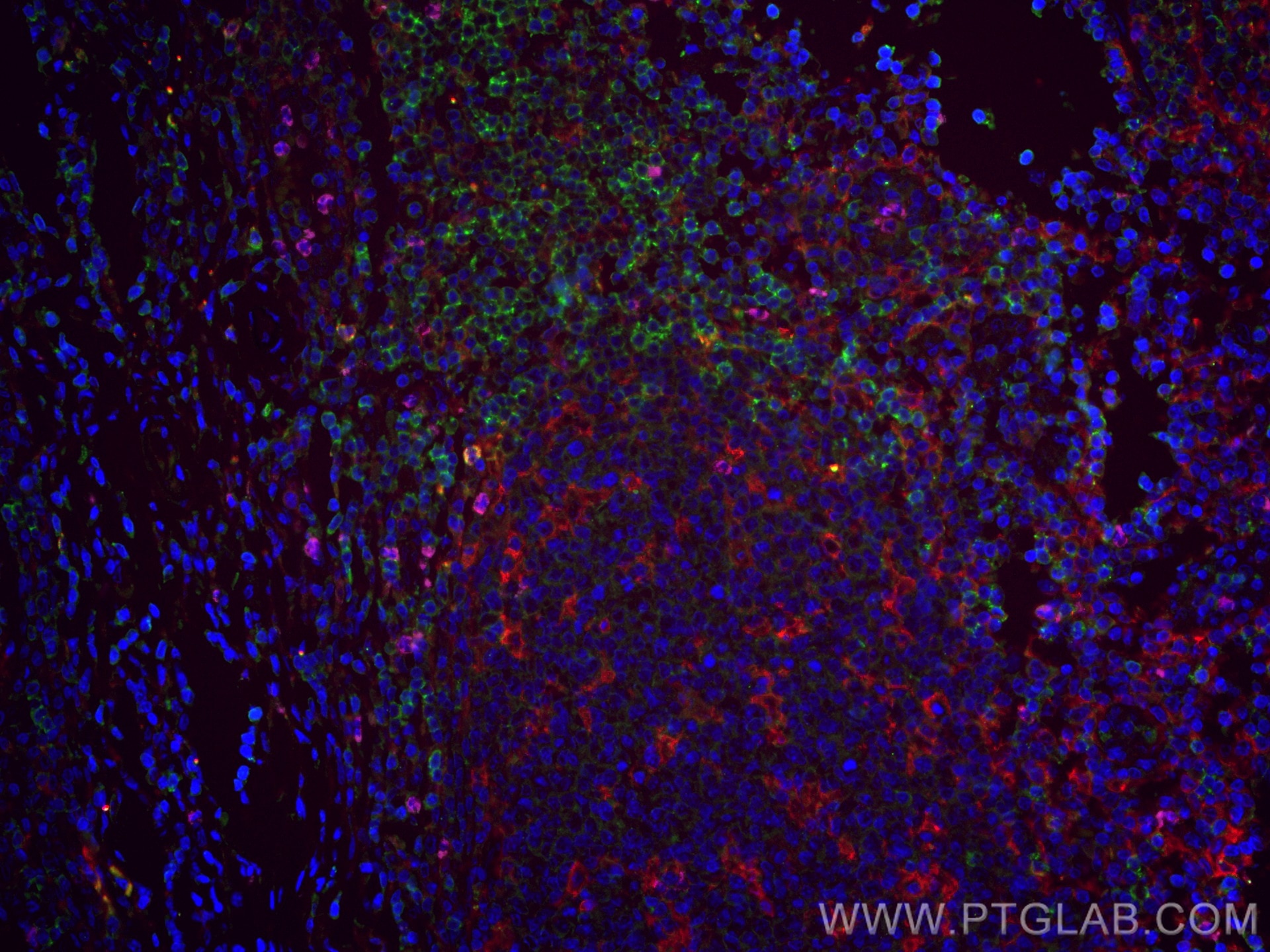 Immunofluorescence (IF) / fluorescent staining of human tonsillitis tissue using CoraLite® Plus 647-conjugated PD-1/CD279 Monoclona (CL647-66220)