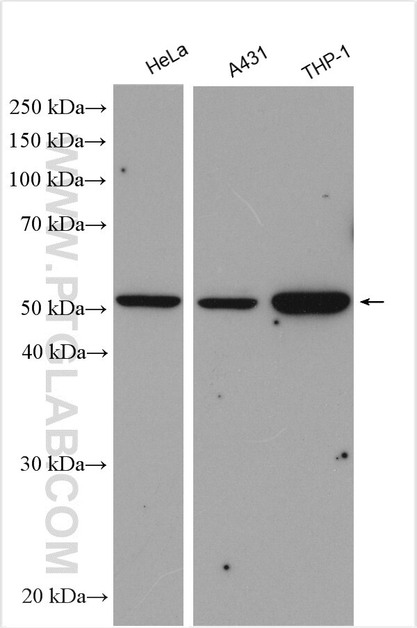 Western Blot (WB) analysis of various lysates using PD-ECGF Polyclonal antibody (12383-1-AP)