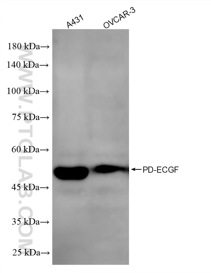 Western Blot (WB) analysis of various lysates using PD-ECGF Recombinant monoclonal antibody (86618-3-RR)