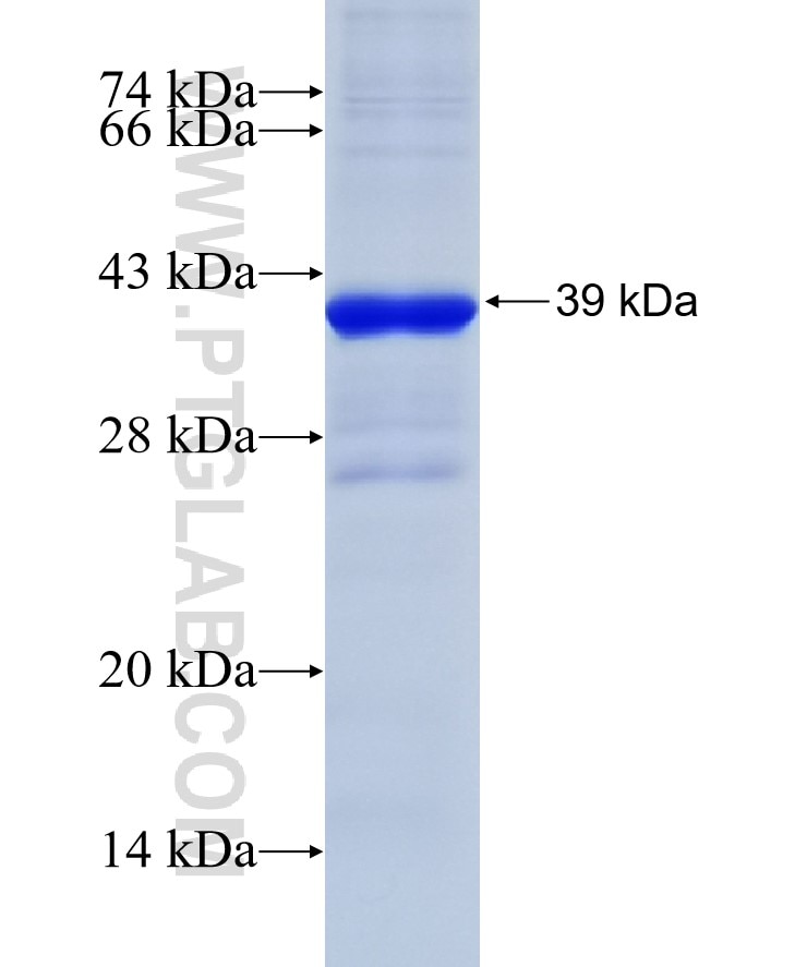 PD-ECGF fusion protein Ag28631 SDS-PAGE