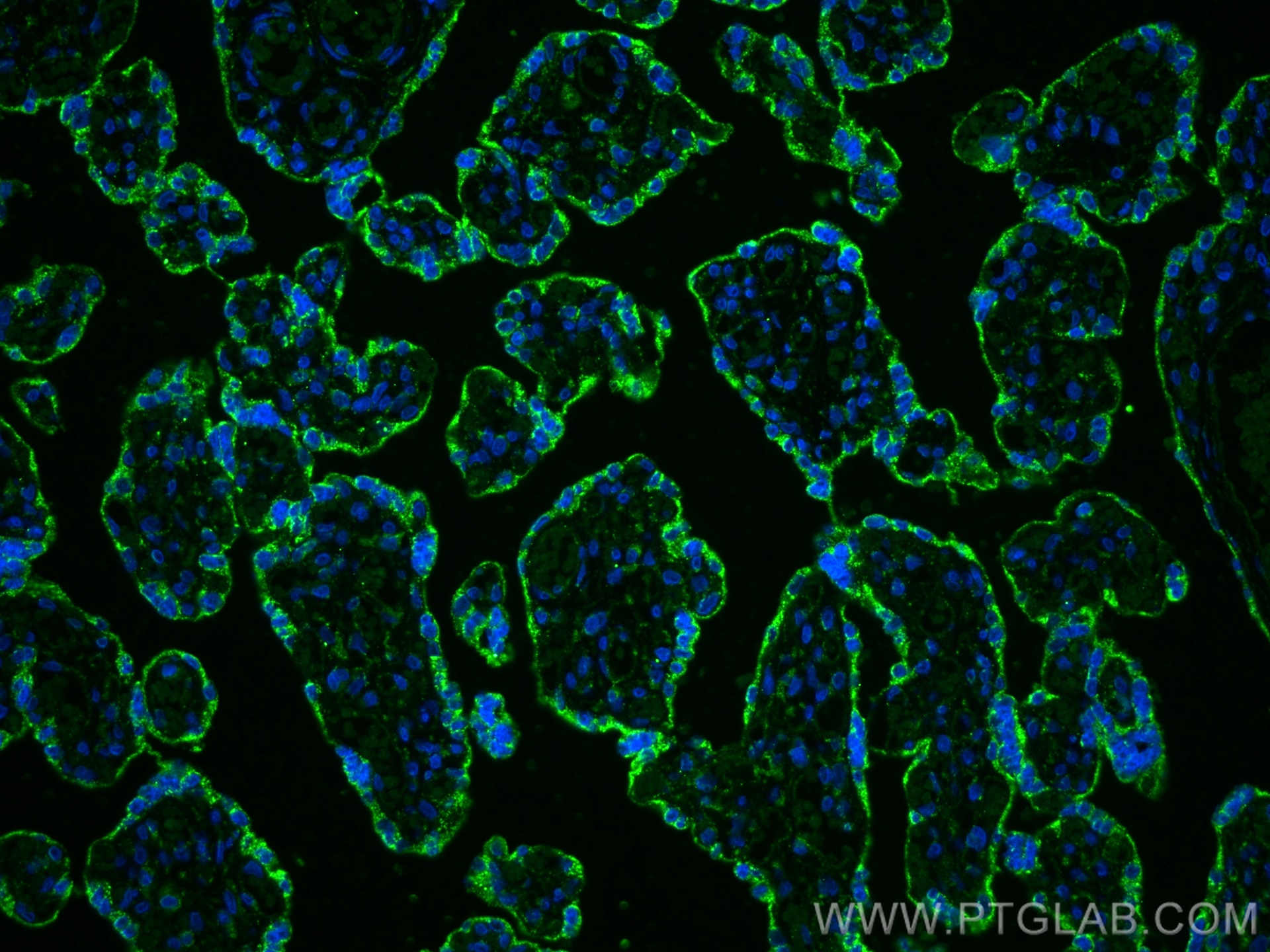 Immunofluorescence (IF) / fluorescent staining of human placenta tissue using PD-L1/CD274 Recombinant antibody (83906-6-RR)