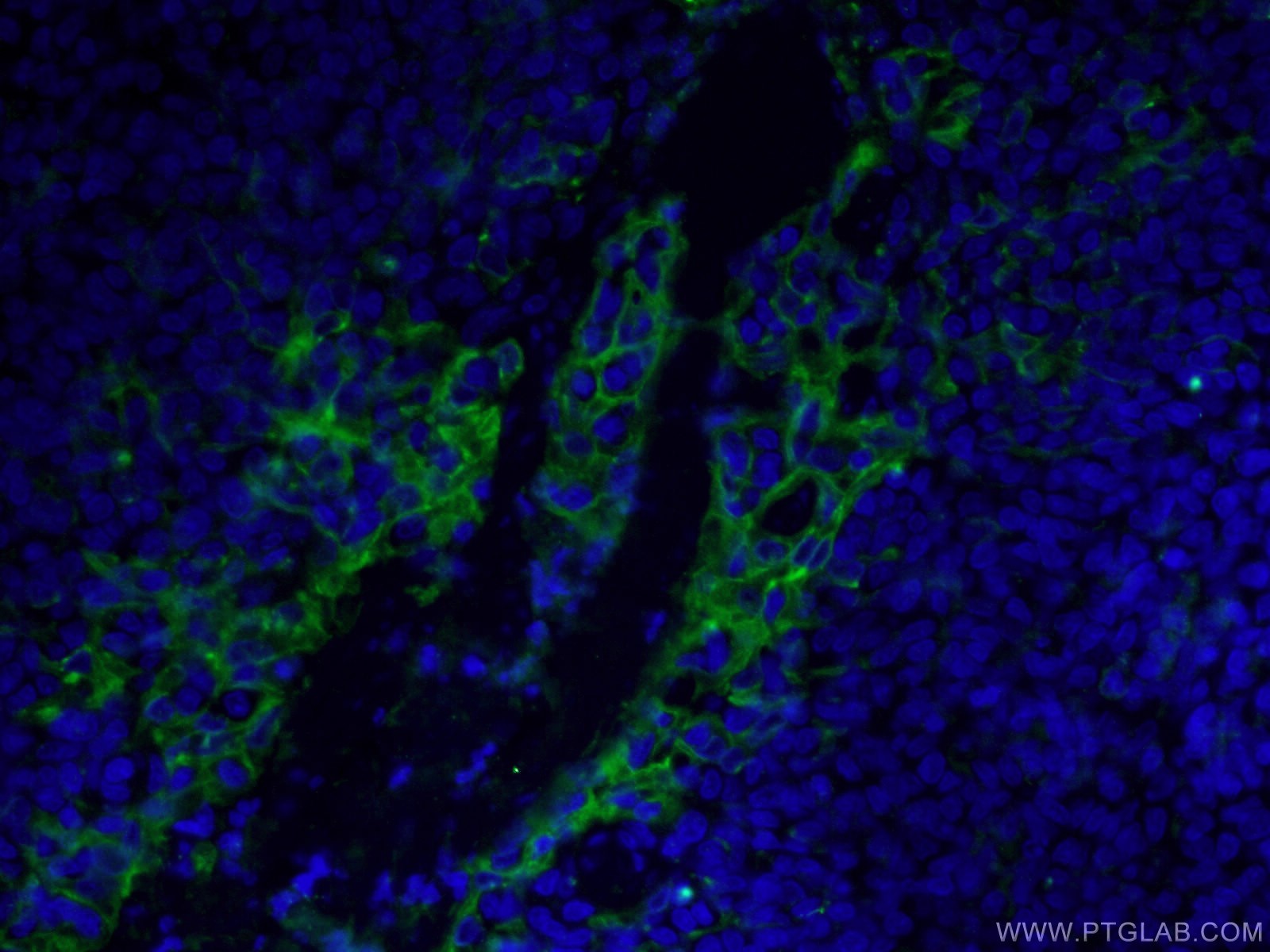 Immunofluorescence (IF) / fluorescent staining of human tonsillitis tissue using PD-L1/CD274 (C-terminal) Polyclonal antibody (28076-1-AP)