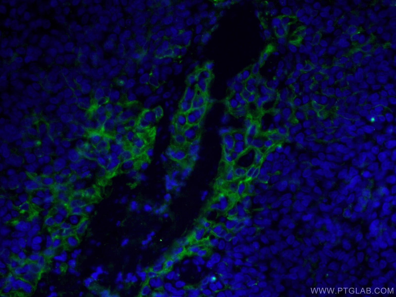 IF Staining of human tonsillitis using 28076-1-AP