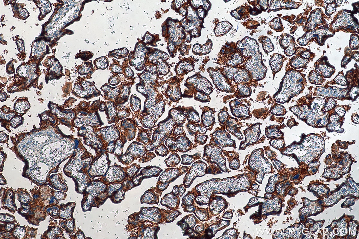 Immunohistochemistry (IHC) staining of human placenta tissue using PD-L1/CD274 (C-terminal) Polyclonal antibody (28076-1-AP)