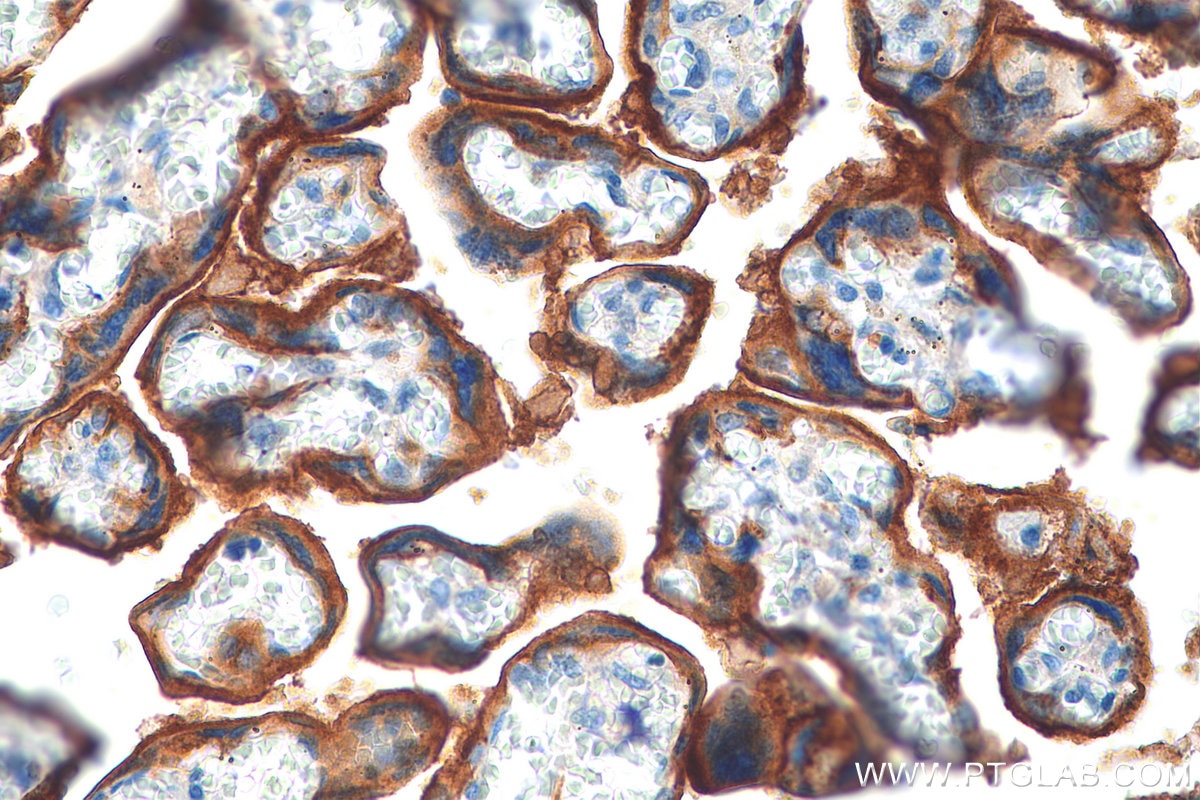 Immunohistochemistry (IHC) staining of human placenta tissue using PD-L1/CD274 (C-terminal) Polyclonal antibody (28076-1-AP)