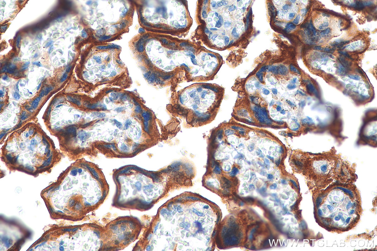 IHC staining of human placenta using 28076-1-AP