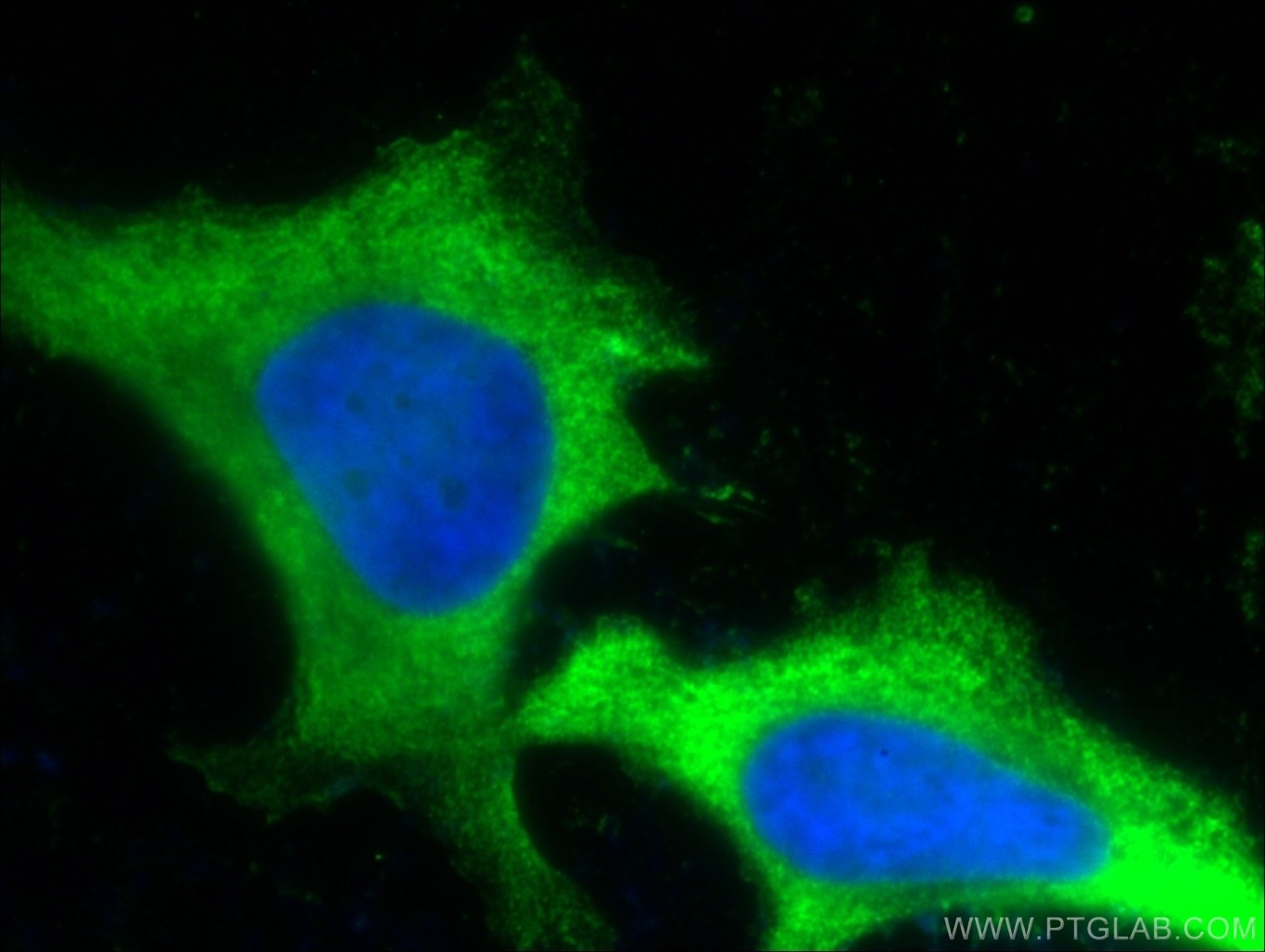 Immunofluorescence (IF) / fluorescent staining of HeLa cells using PD-L1/CD274 Monoclonal antibody (66248-1-Ig)