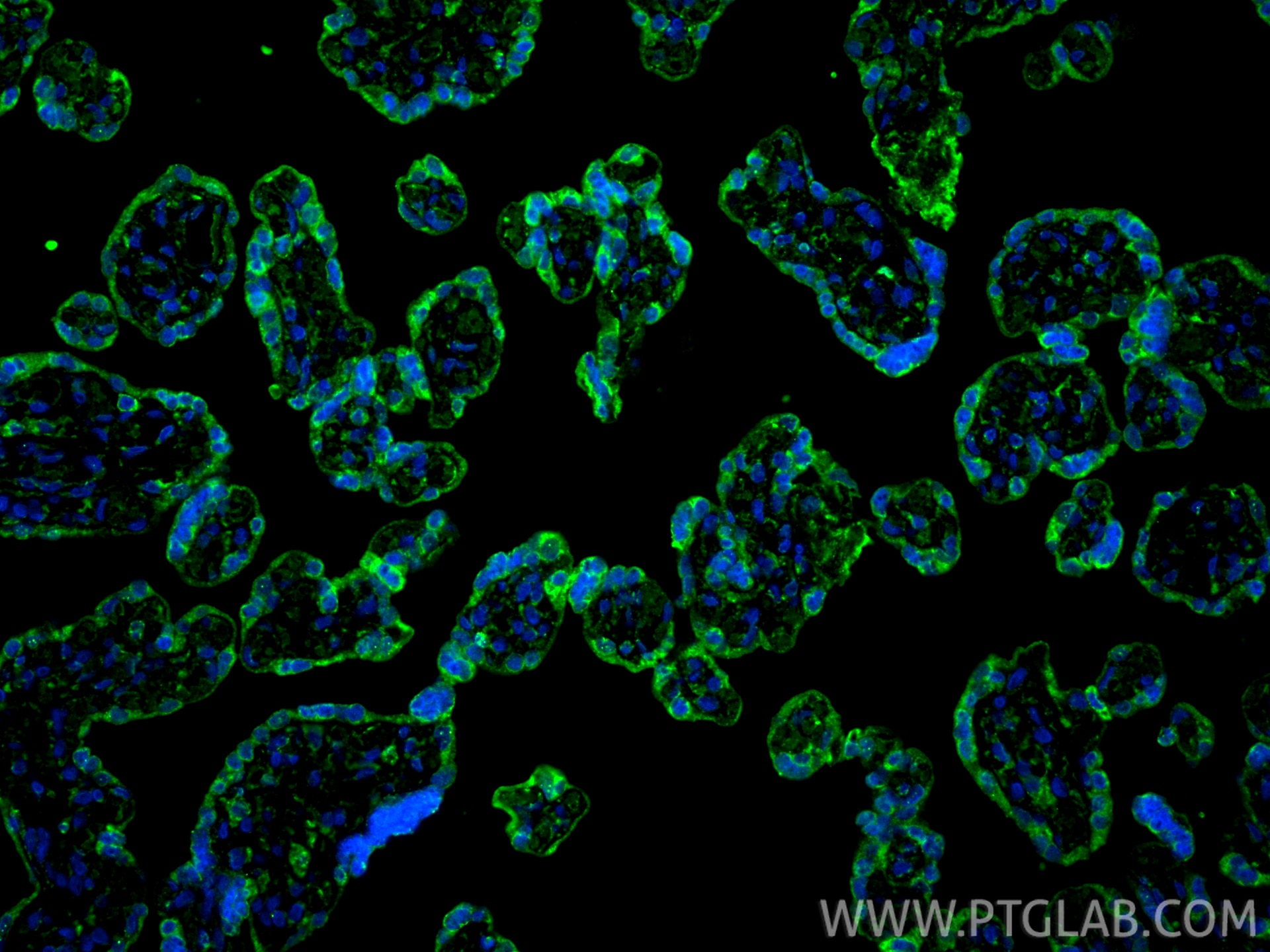 Immunofluorescence (IF) / fluorescent staining of human placenta tissue using PD-L1/CD274 Monoclonal antibody (66248-1-Ig)