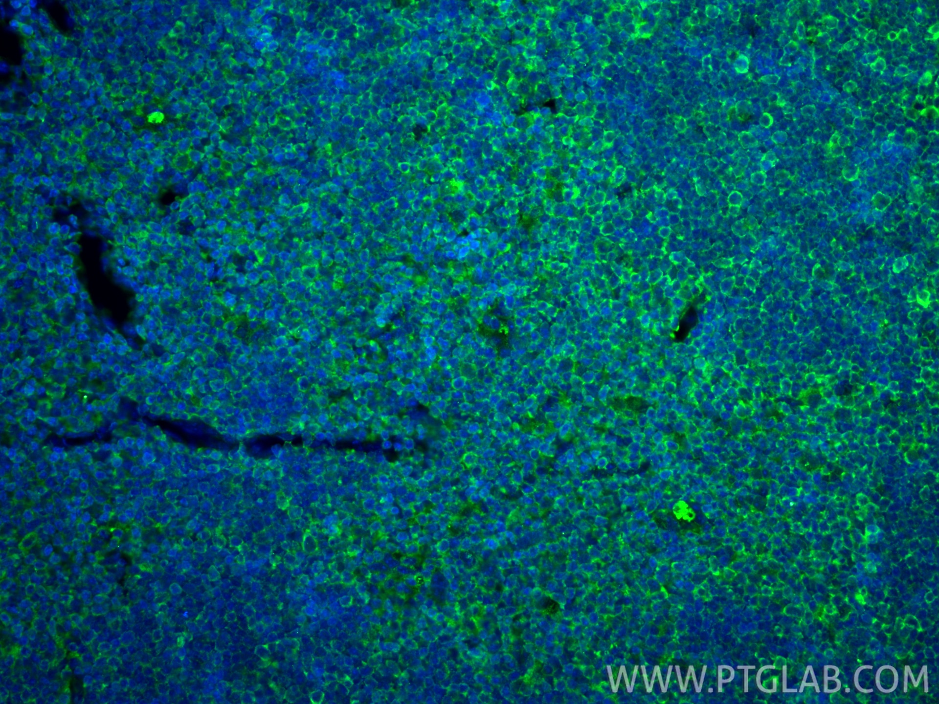 Immunofluorescence (IF) / fluorescent staining of mouse thymus tissue using PD-L1/CD274 Monoclonal antibody (66248-1-Ig)