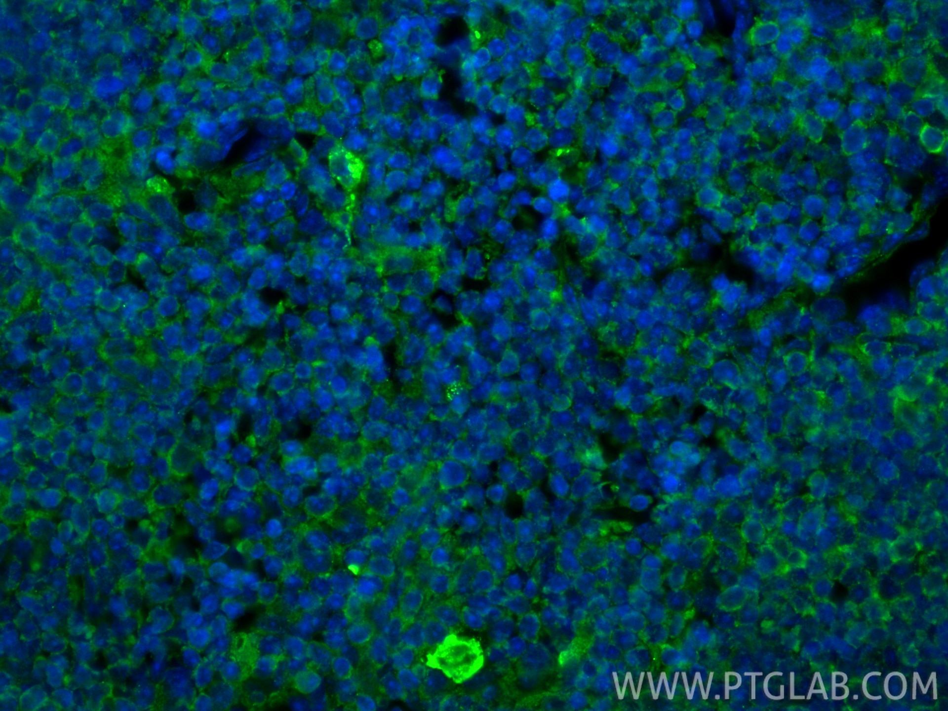 Immunofluorescence (IF) / fluorescent staining of mouse thymus tissue using PD-L1/CD274 Monoclonal antibody (66248-1-Ig)