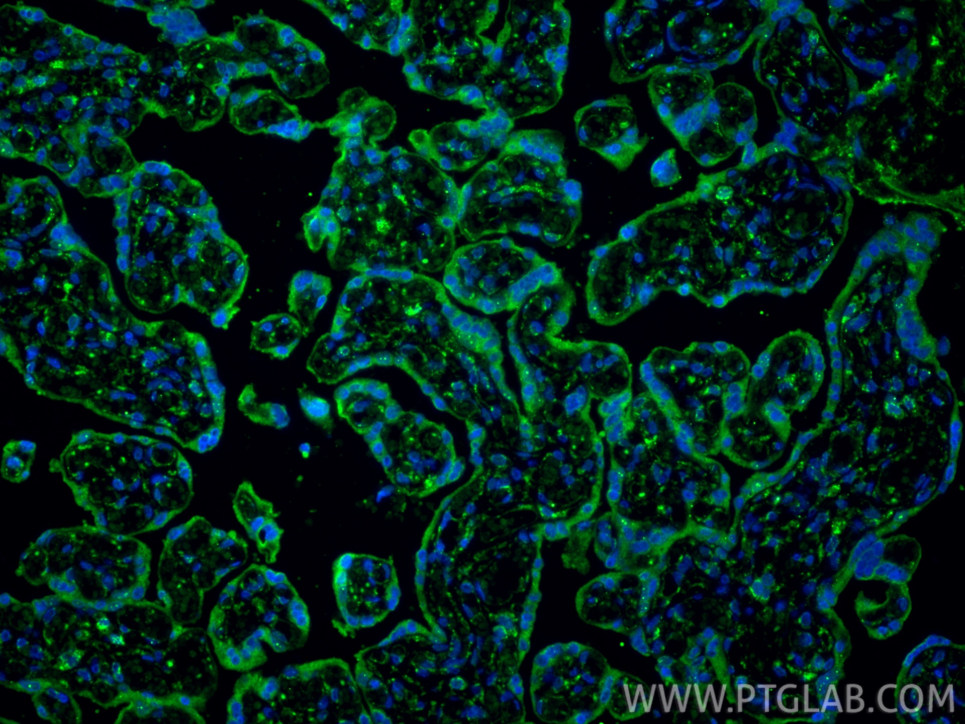 Immunofluorescence (IF) / fluorescent staining of human placenta tissue using PD-L1/CD274 Monoclonal antibody (66248-1-Ig)
