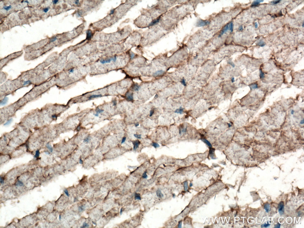 Immunohistochemistry (IHC) staining of mouse heart tissue using PD-L1/CD274 Monoclonal antibody (66248-1-Ig)