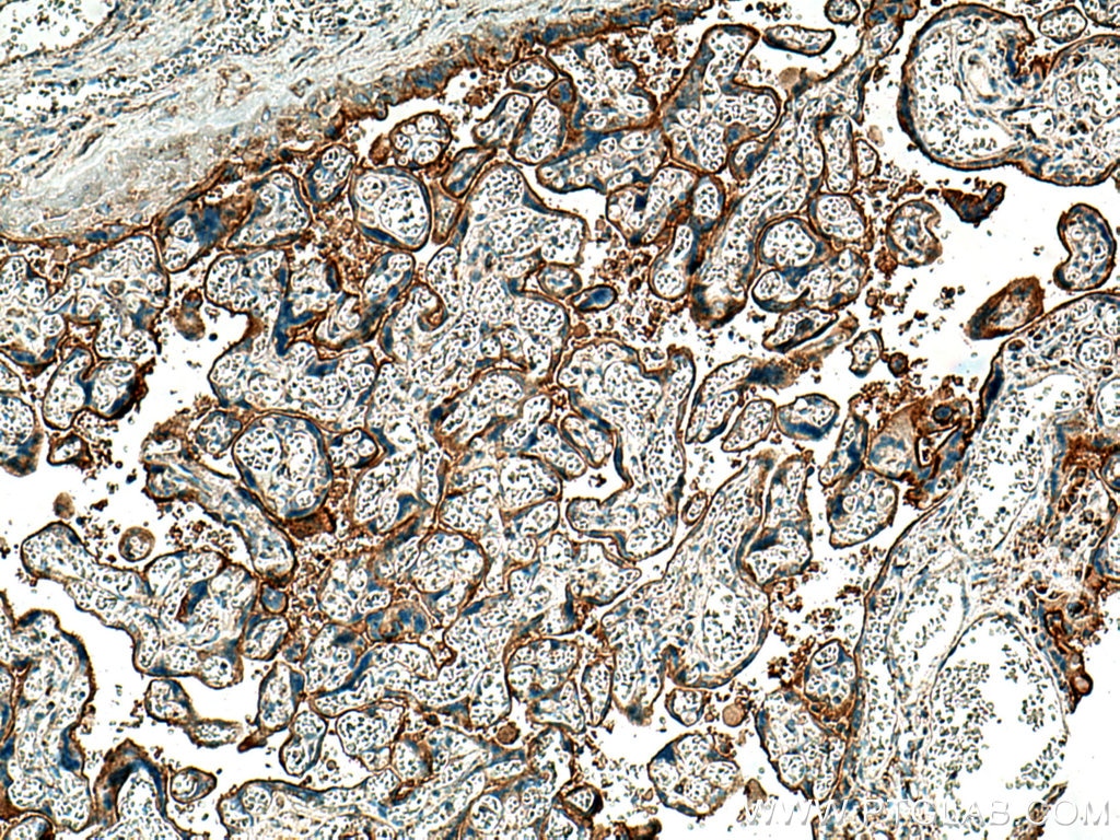 IHC staining of human placenta using 66248-1-Ig