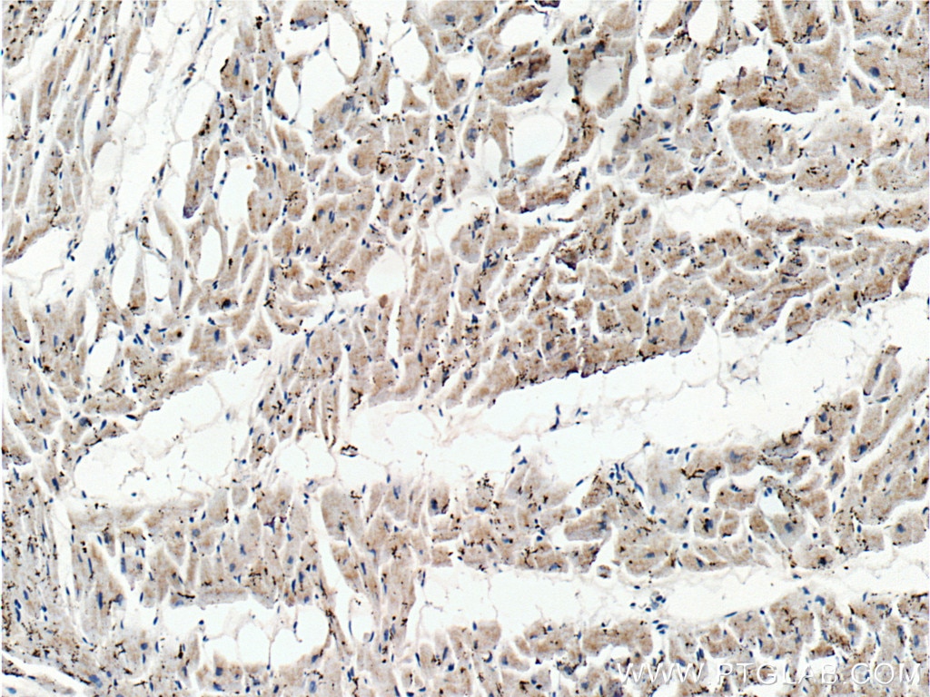 Immunohistochemistry (IHC) staining of human heart tissue using PD-L1/CD274 Monoclonal antibody (66248-1-Ig)