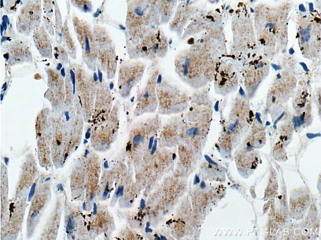 IHC staining of human heart using 66248-1-Ig