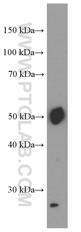 WB analysis of human placenta using 66248-1-Ig