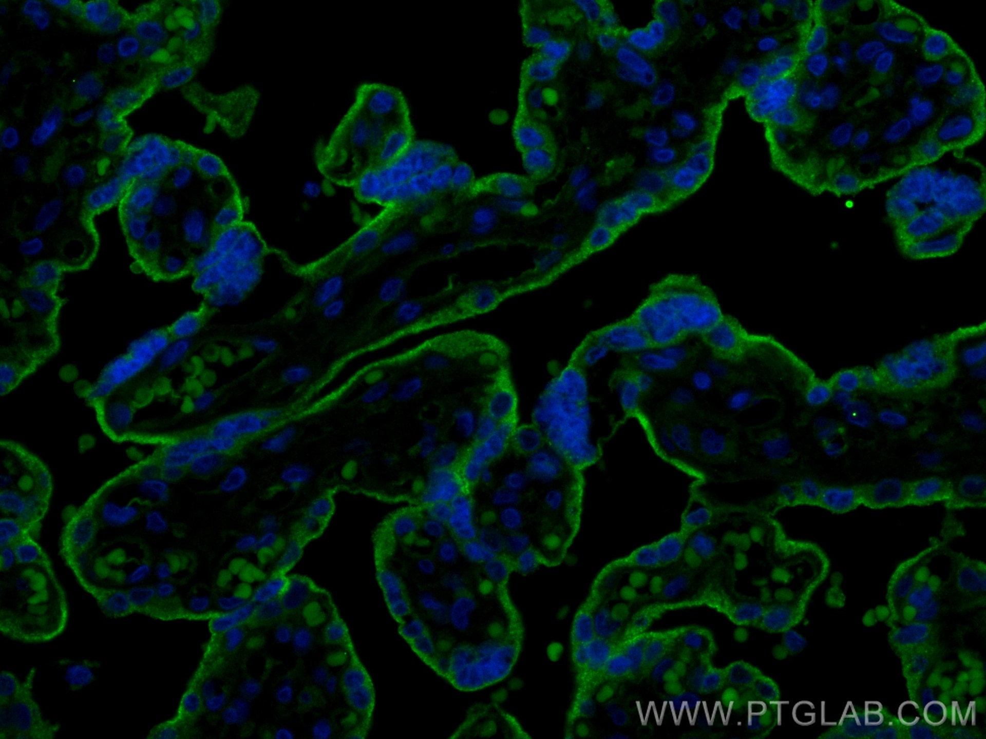 Immunofluorescence (IF) / fluorescent staining of human placenta tissue using PD-L1/CD274 Recombinant antibody (83600-2-RR)