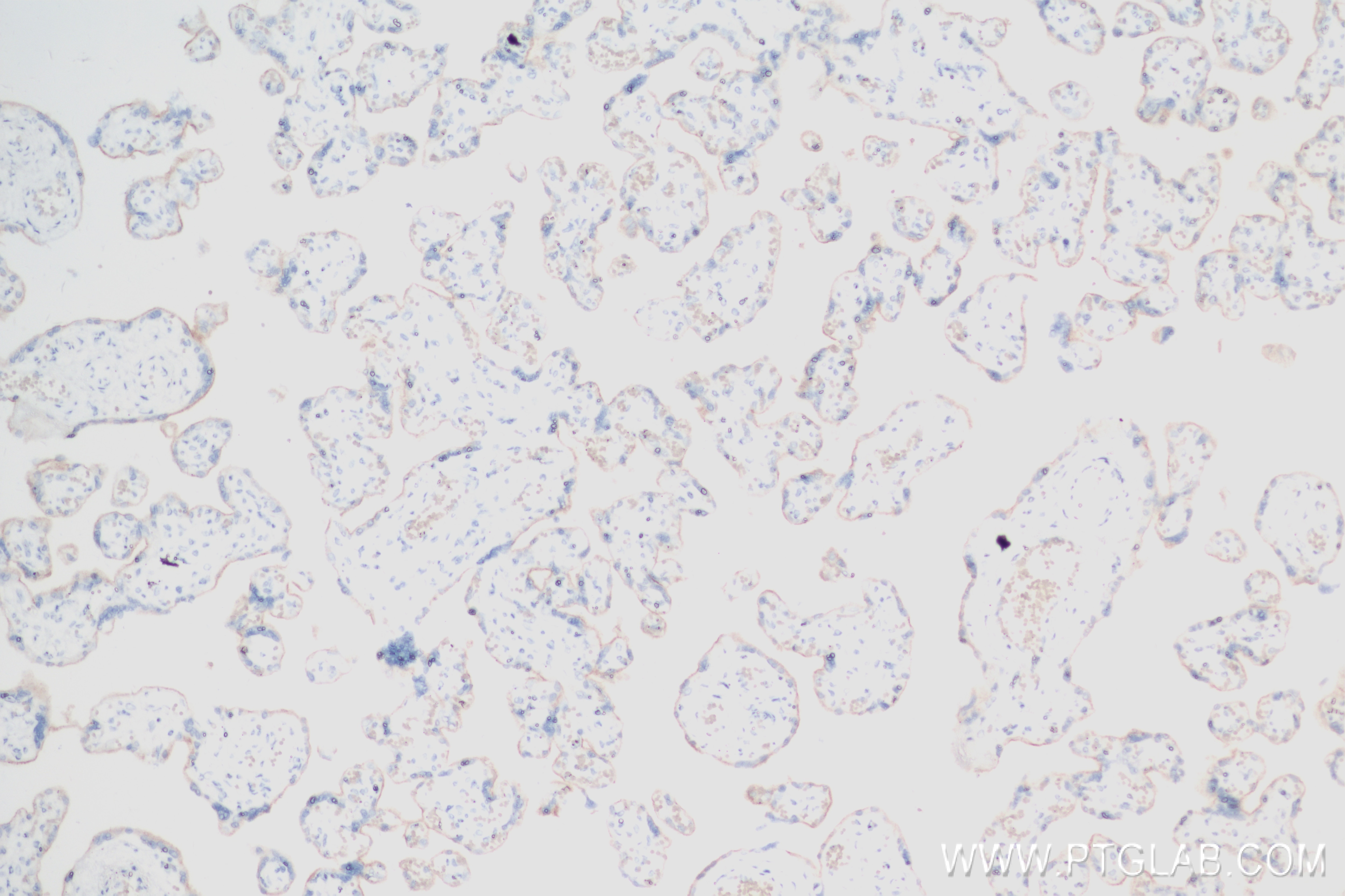 Immunohistochemistry (IHC) staining of human placenta tissue using PD-L1/CD274 Recombinant monoclonal antibody (83600-2-RR)