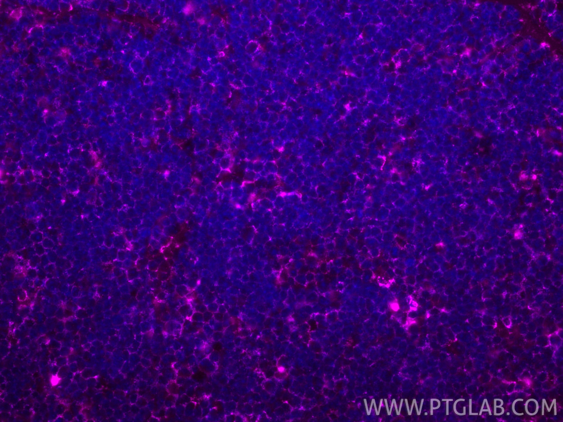 Immunofluorescence (IF) / fluorescent staining of mouse thymus tissue using APC-conjugated PD-L1/CD274 Monoclonal antibody (APC-66248)