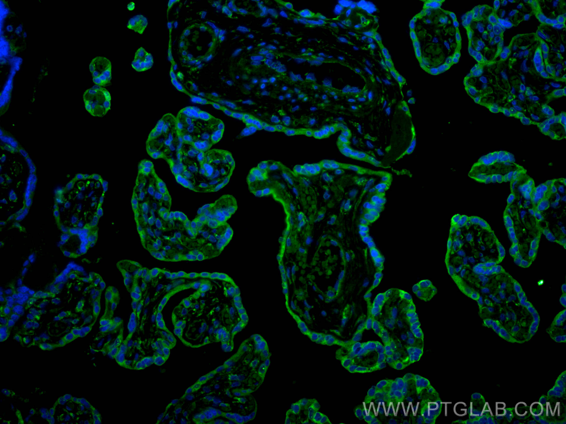 Immunofluorescence (IF) / fluorescent staining of human placenta tissue using CoraLite® Plus 488-conjugated PD-L1/CD274 Monoclon (CL488-66248)