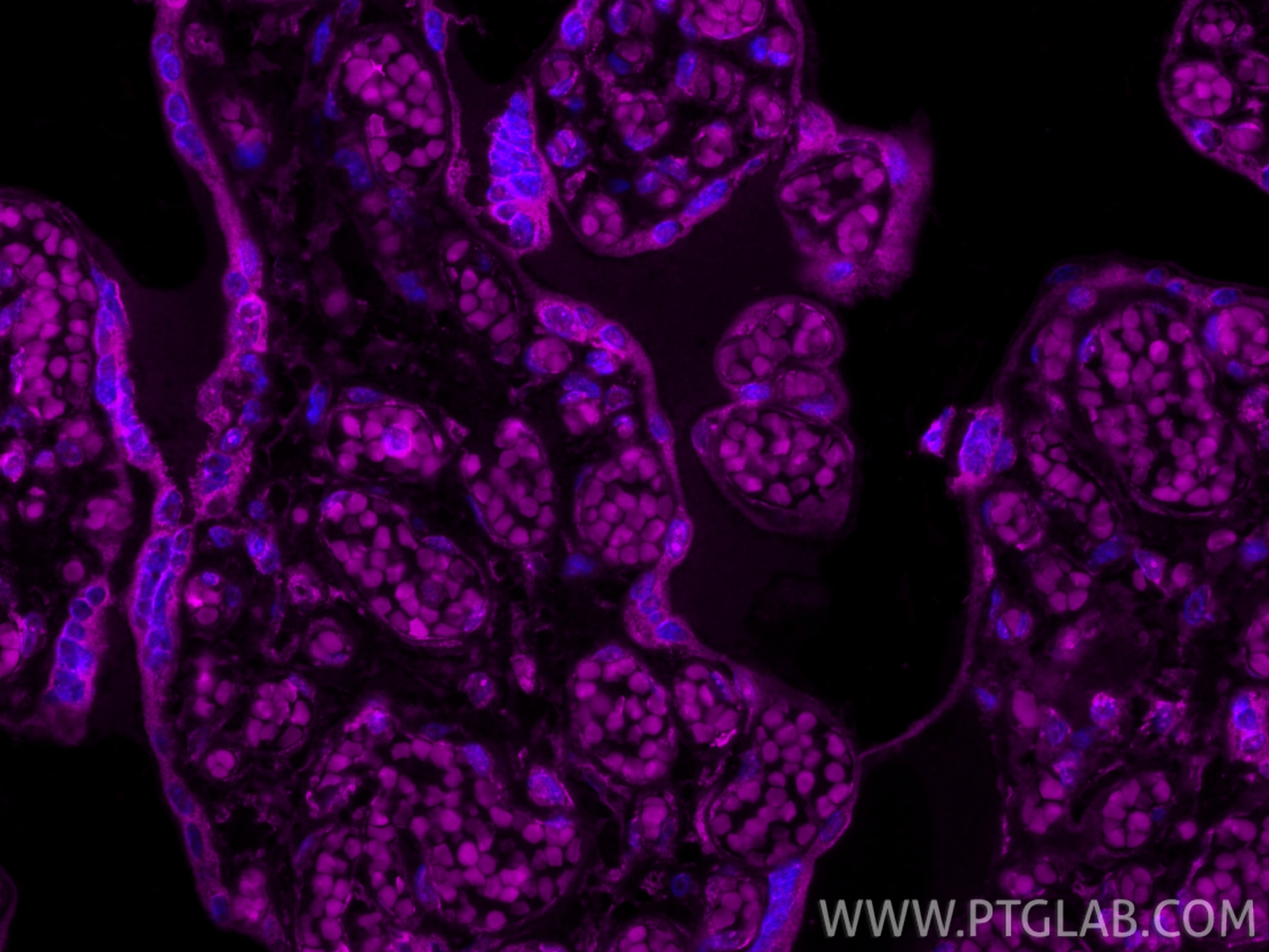 IF Staining of human placenta using CL647-66248 Immunofluorescence (IF) / fluorescent staining of human placenta tissue using CoraLite® Plus 647-conjugated PD-L1/CD274 Monoclon (CL647-66248)