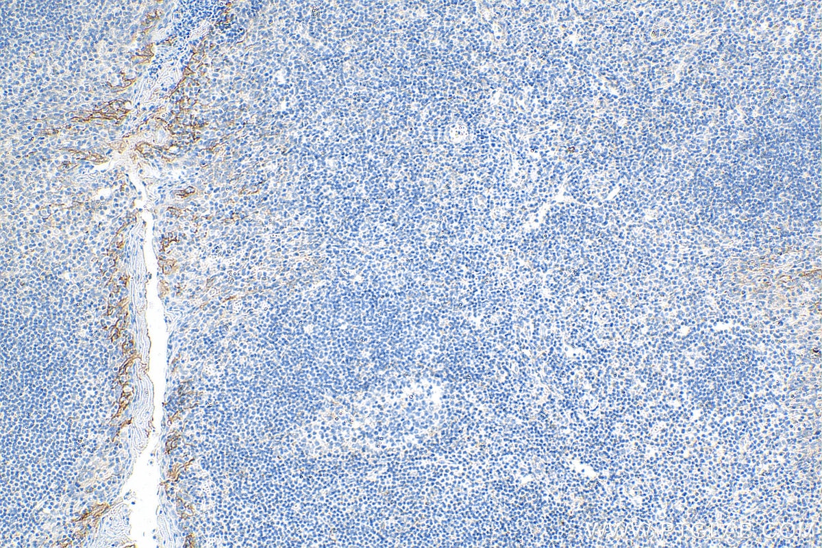 Immunohistochemistry (IHC) staining of human tonsillitis tissue using Biotin-conjugated PD-L1/CD274 (C-terminal) Polyclo (Biotin-28076)
