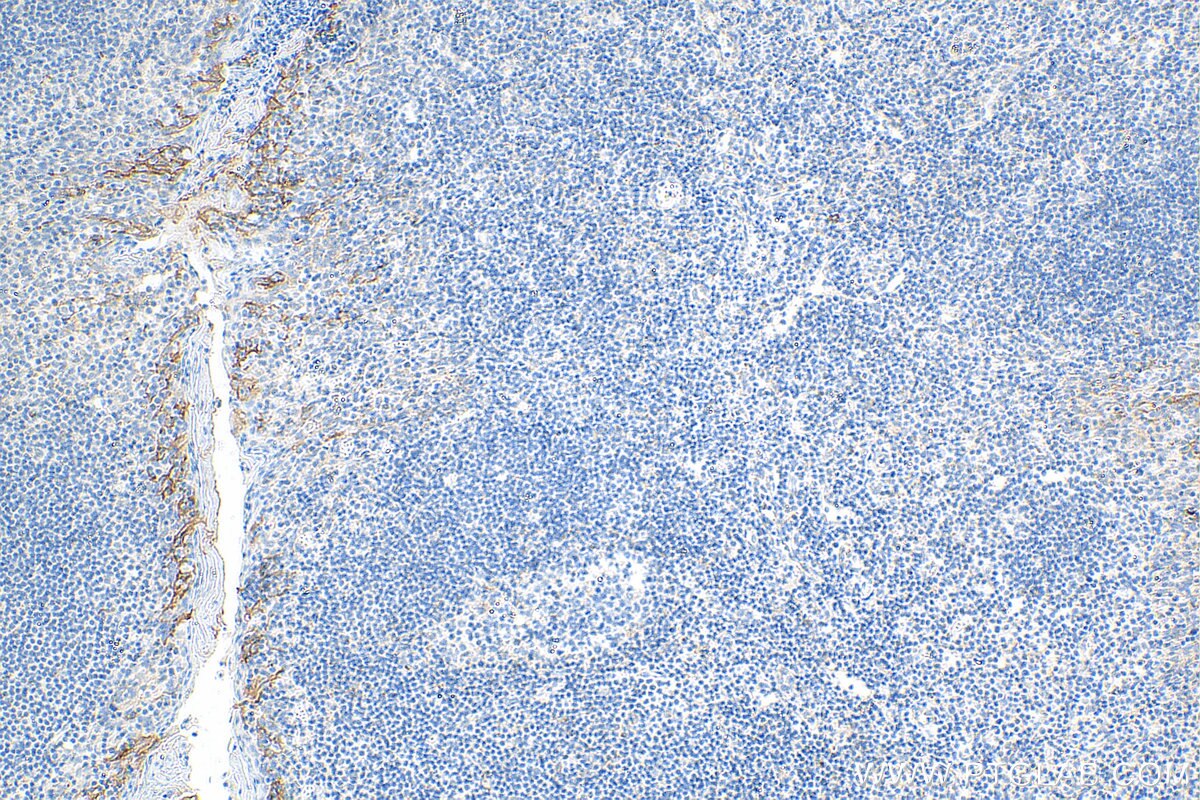 Immunohistochemistry (IHC) staining of human tonsillitis tissue using Biotin-conjugated PD-L1/CD274 (C-terminal) Polyclo (Biotin-28076)