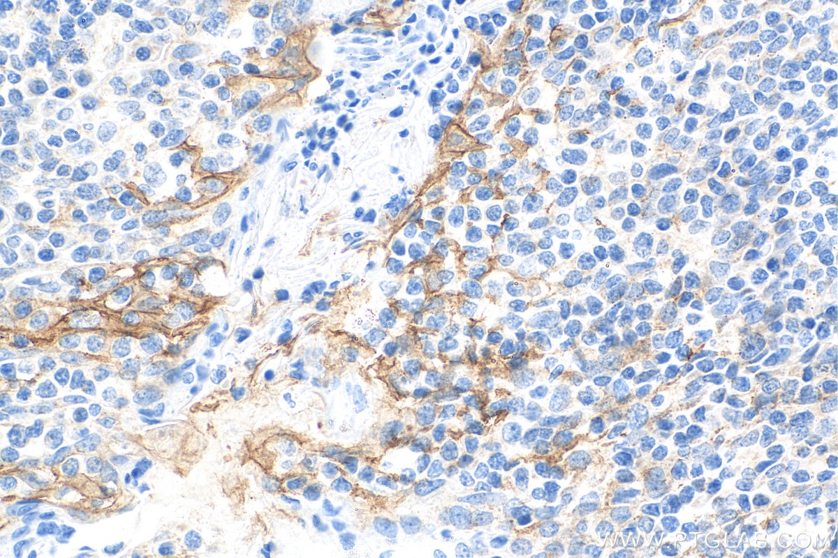 Immunohistochemistry (IHC) staining of human tonsillitis tissue using Biotin-conjugated PD-L1/CD274 (C-terminal) Polyclo (Biotin-28076)