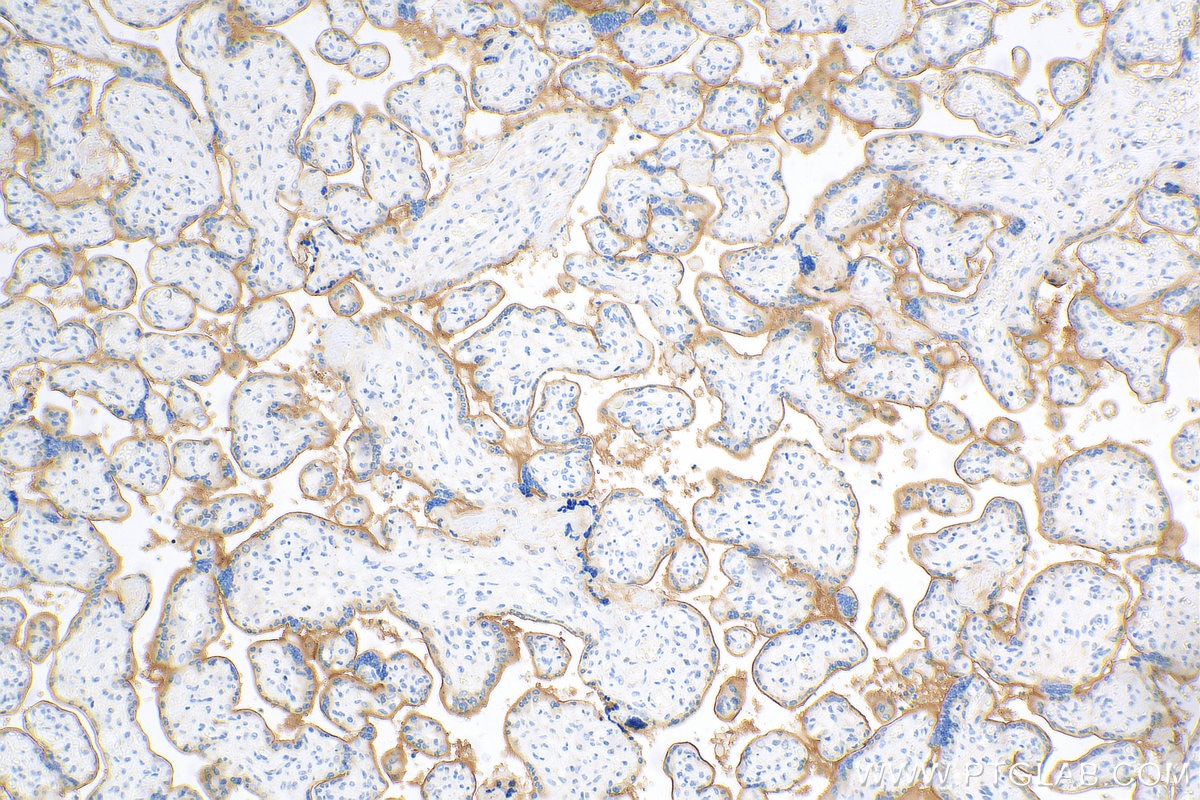 Immunohistochemistry (IHC) staining of human placenta tissue using Biotin-conjugated PD-L1/CD274 (C-terminal) Polyclo (Biotin-28076)