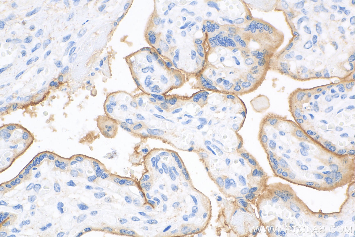 Immunohistochemistry (IHC) staining of human placenta tissue using Biotin-conjugated PD-L1/CD274 (C-terminal) Polyclo (Biotin-28076)