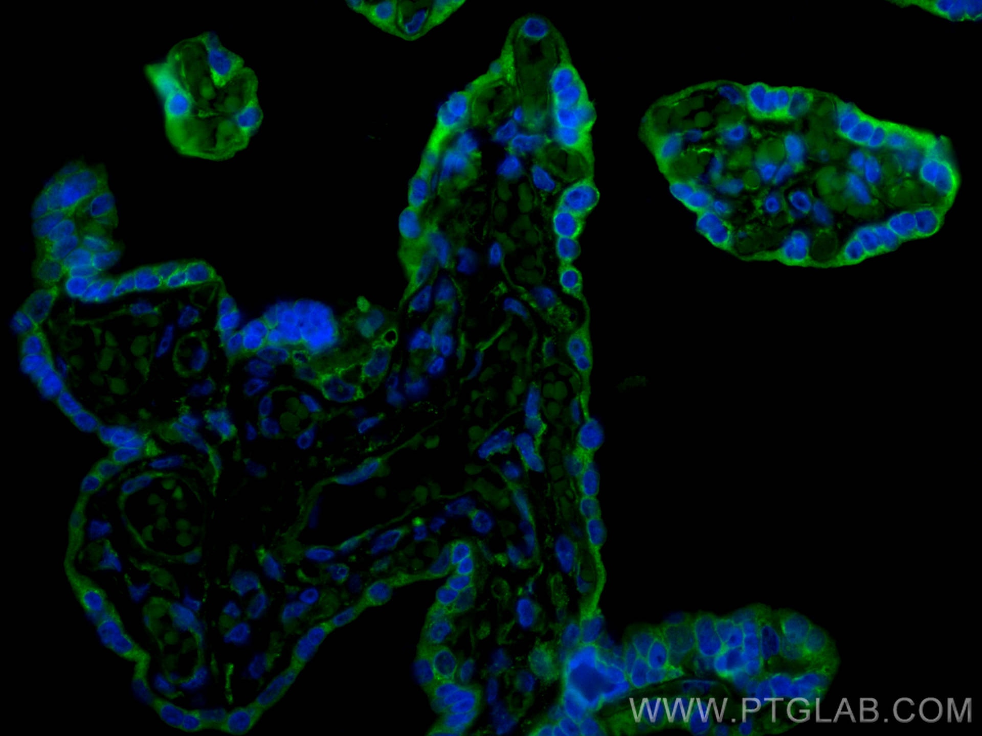 Immunofluorescence (IF) / fluorescent staining of human placenta tissue using CoraLite® Plus 488-conjugated PD-L1/CD274 (C-termi (CL488-28076)