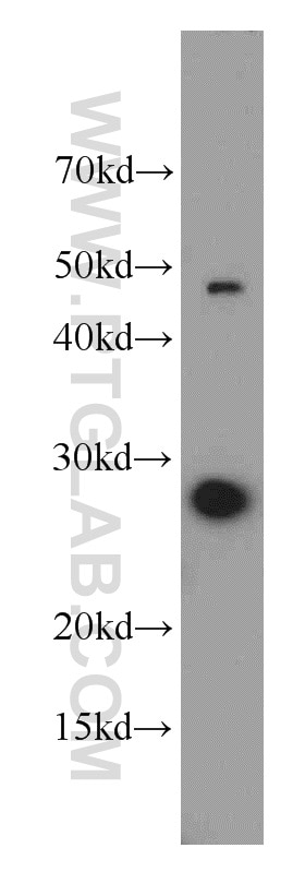 WB analysis of MCF-7 using 15081-1-AP