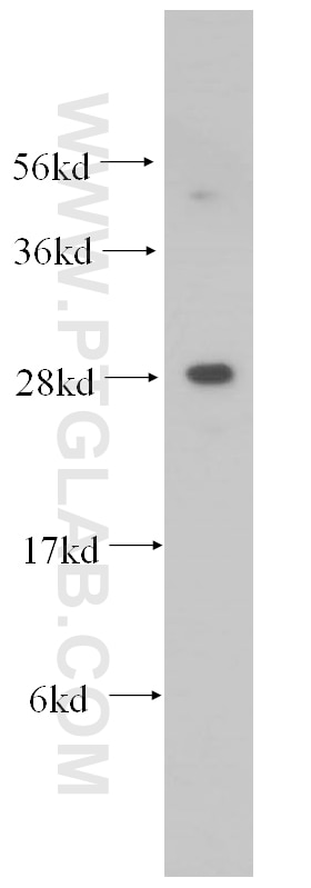 Western Blot (WB) analysis of MCF-7 cells using PDAP1 Polyclonal antibody (15081-1-AP)