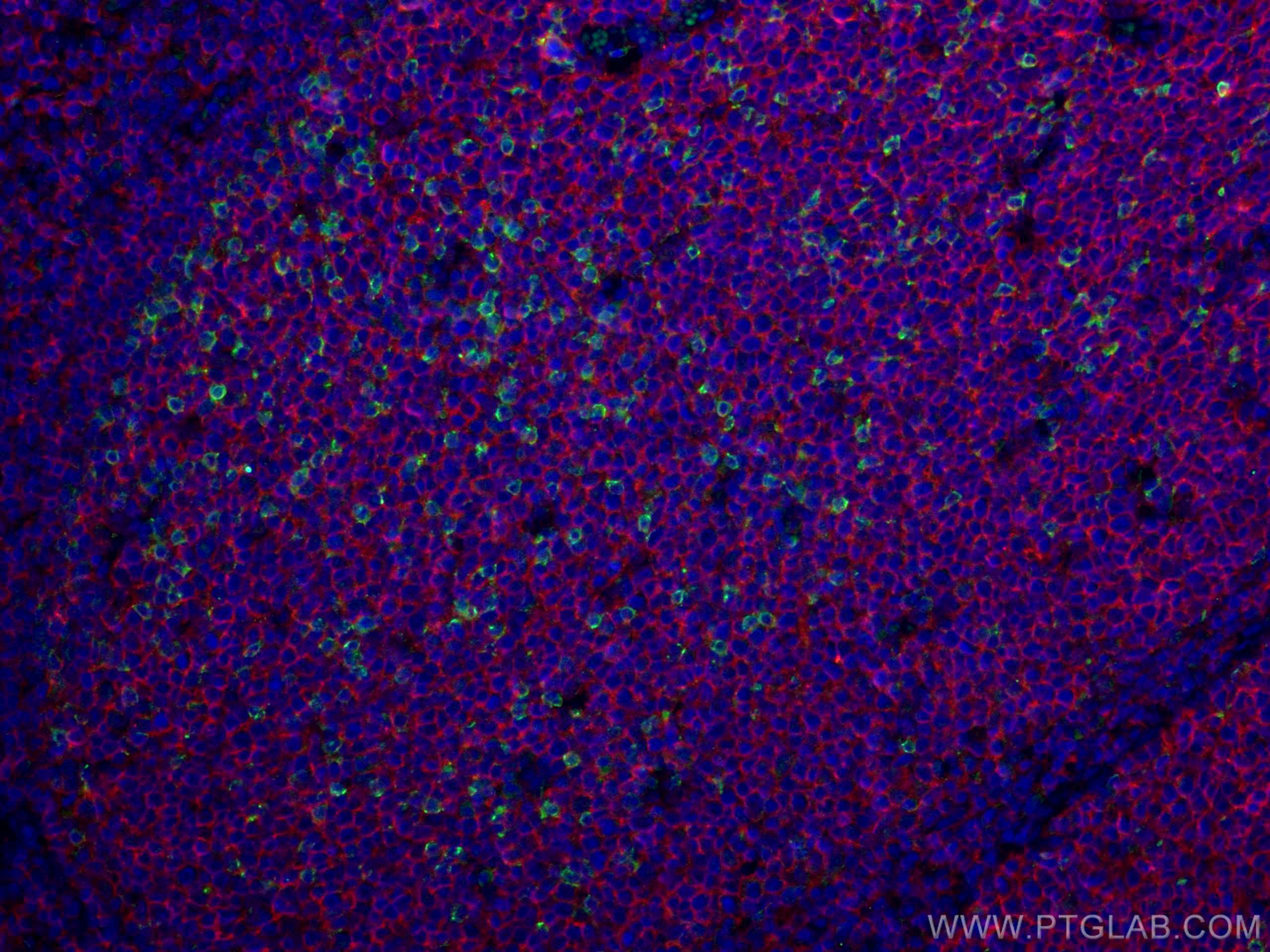 Immunofluorescence (IF) / fluorescent staining of human tonsillitis tissue using PD-1/CD279 Polyclonal antibody (18106-1-AP)