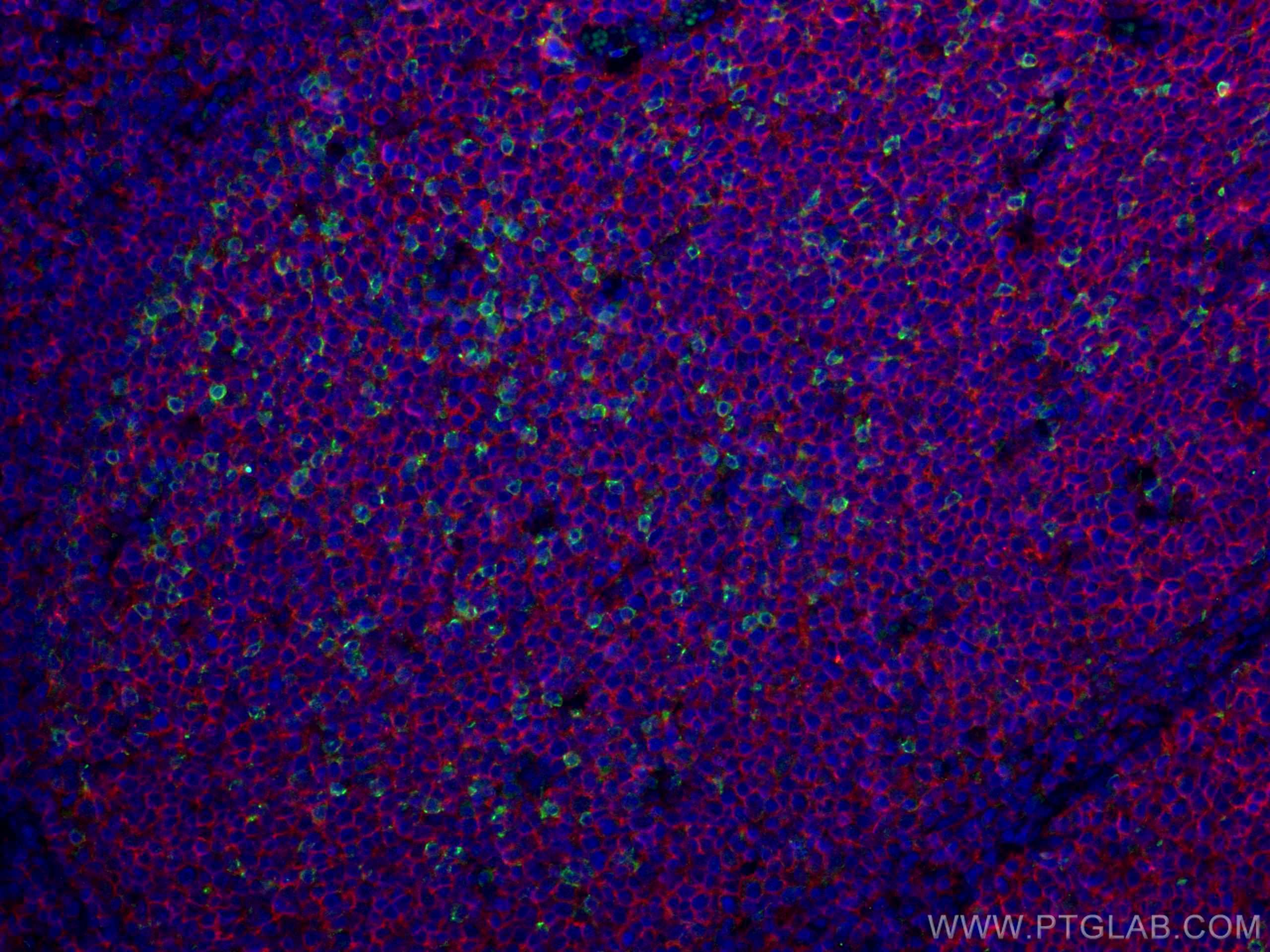 IF Staining of human tonsillitis using 18106-1-AP